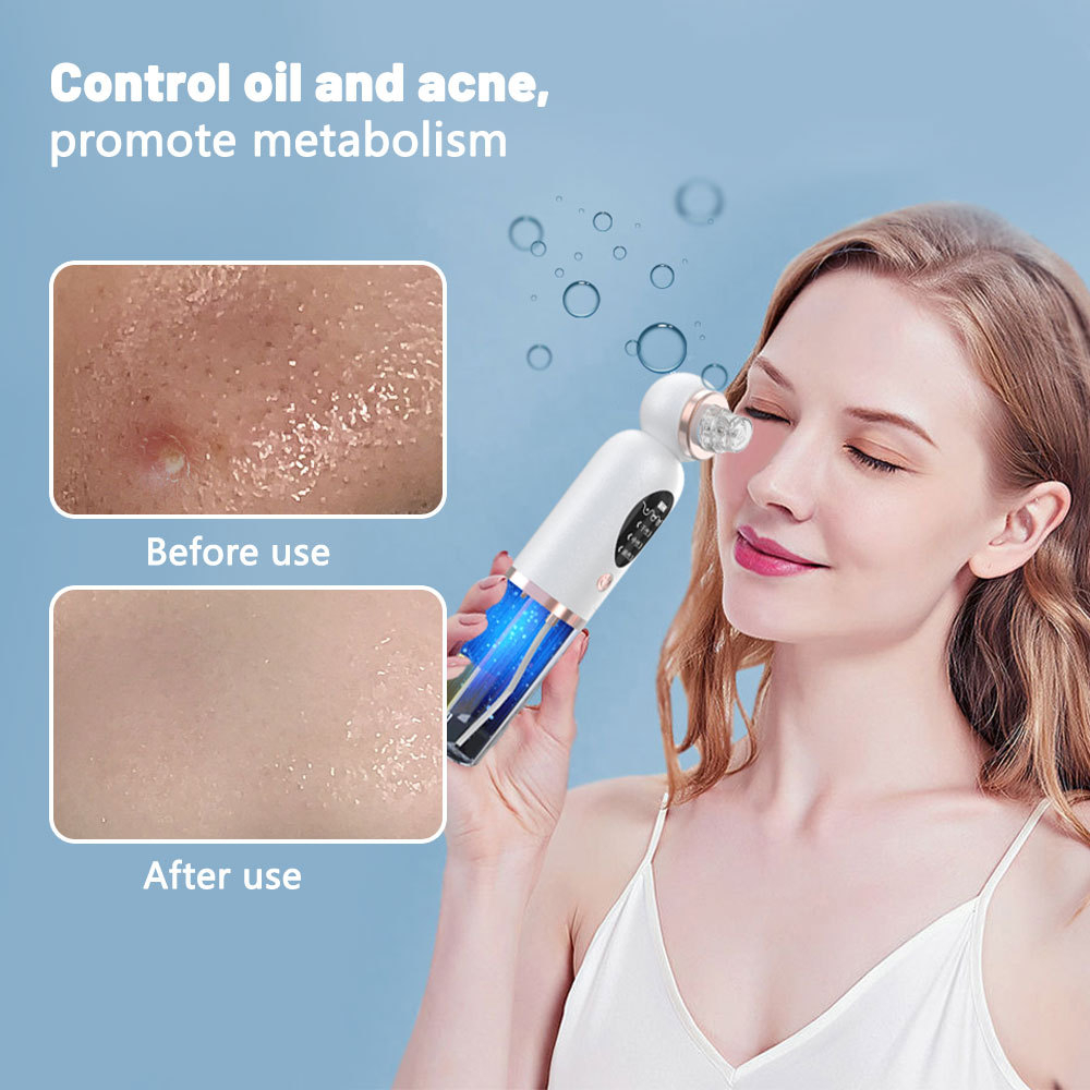 Pore Vacuum - เครื่องดูดสิวเสี้ยน กำจัดสิวอุดตัน ทำความสะอาดผิวหน้า แบบไฟฟ้า กำจัดสิวหัวดำ ชาร์จ