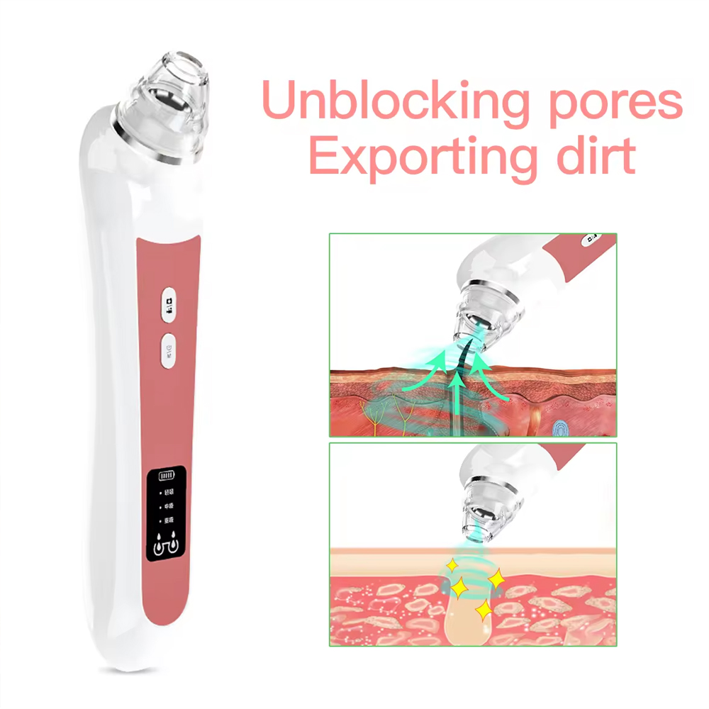 เครื่องดูดกำจัดสิวหัวดำ6เครื่อ - Pore Vacuum บทวิจารณ์และราคา