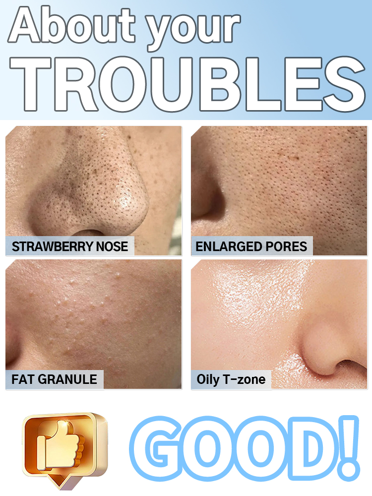 เครื่องดูดสิวเสี้ยนและทำความสะ - Pore Vacuum บทวิจารณ์และราคา