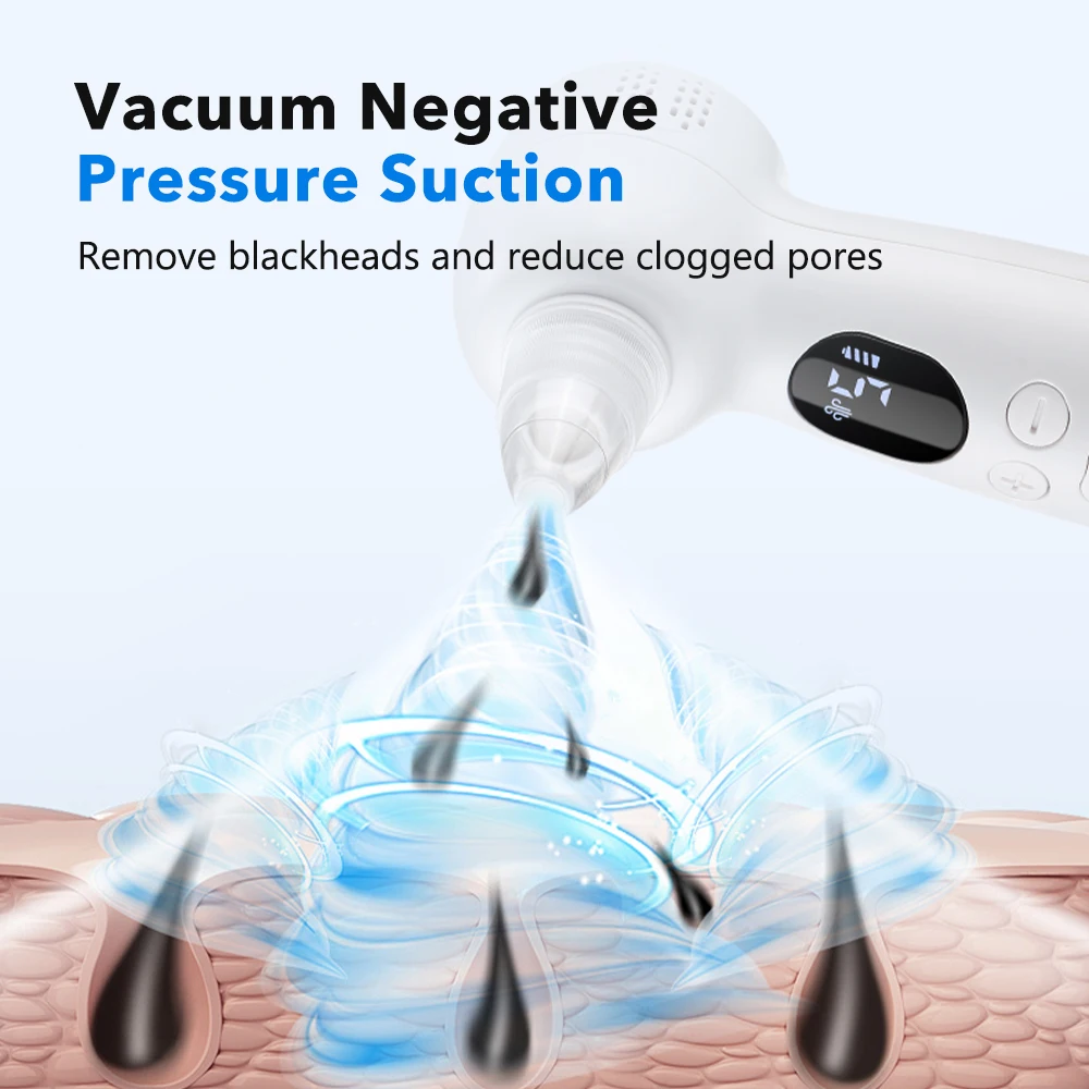 เครื่องดูดฝุ่นกำจัดสิวหัวดำพร้ - Pore Vacuum บทวิจารณ์และราคา