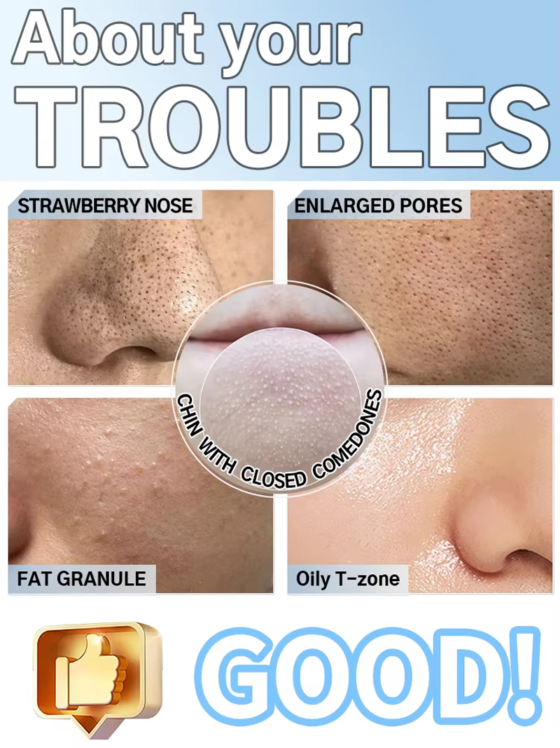 เครื่องดูดสิวเสี้ยนและทำความสะ - Pore Vacuum บทวิจารณ์และราคา