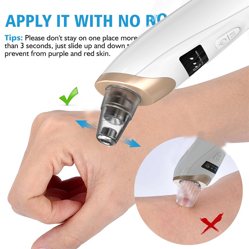 เครื่องกำจัดสิวเสี้ยน สิวอักเส - Pore Vacuum บทวิจารณ์และราคา