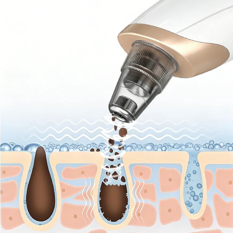 เครื่องดูดสิวเสี้ยนแบบชาร์จไฟไ - Pore Vacuum บทวิจารณ์และราคา